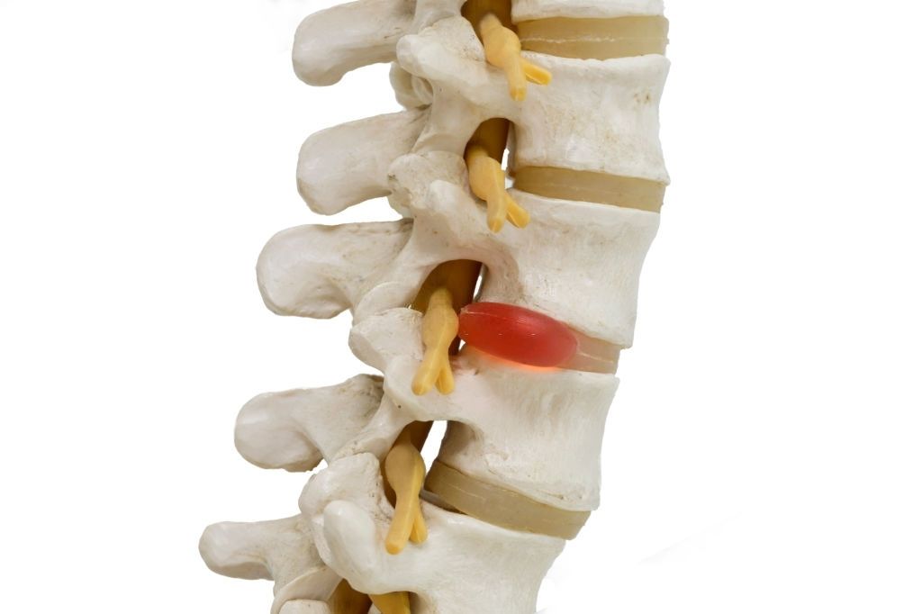discos de la columna vertebral