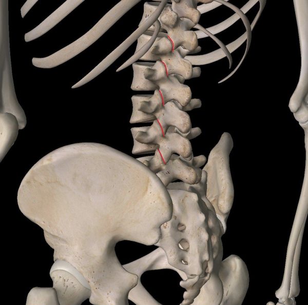 tratamiento lumbalgia - dolor de espalda producido por la artrosis - radiofrecuencia