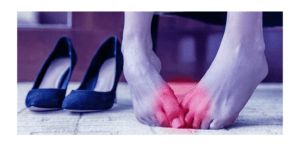 neuroma de Morton